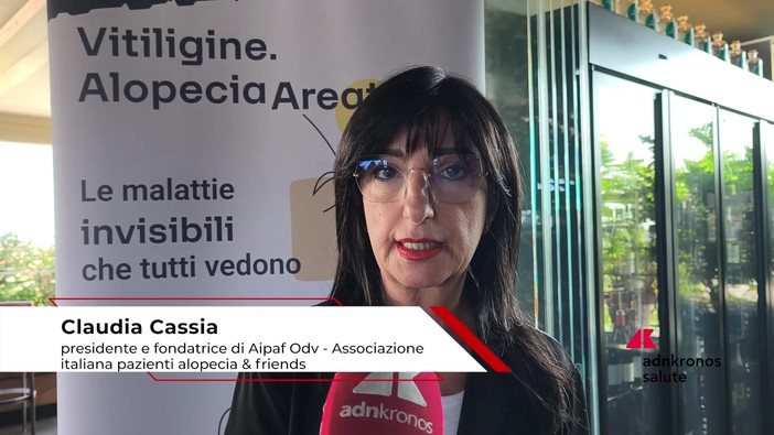 Farmaci: Cassia (Aipaf), 'dare voce ai pazienti, alopecia ancora non riconosciuta dal Ssn' Farmaci: Cassia (Aipaf), 'dare voce ai pazienti, alopecia ancora non riconosciuta dal Ssn'