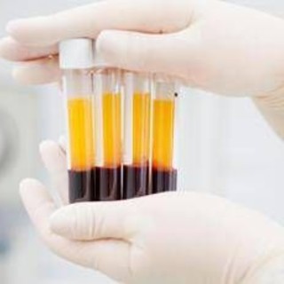 Plasmaderivati, Lecci (Sda Bocconi): &quot;Serve un’innovazione rapida meno costosa&quot;