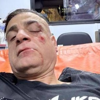 Cicalone, lo youtuber aggredito in metro a Roma: "Infami veri" Cicalone, lo youtuber aggredito in metro a Roma: "Infami veri"