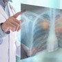 Fine vita, oncologi: &quot;No a Comitato nazionale e a esclusione Ssn, subito confronto&quot;