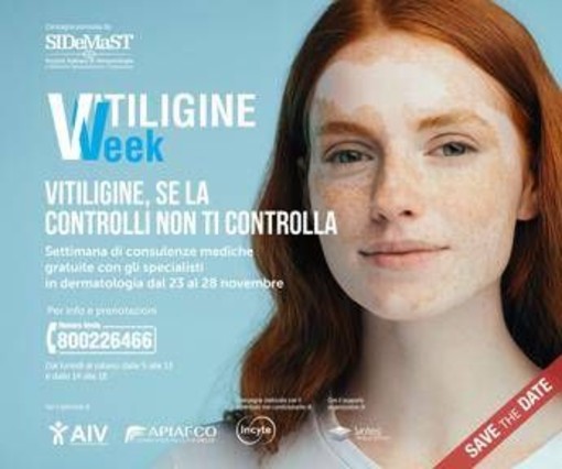 Vitiligine week, Sidemast: "Circa mille consulenze dermatologiche gratuite" Vitiligine week, Sidemast: "Circa mille consulenze dermatologiche gratuite"