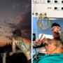 Fedez come sta, la lettera sui social dopo il ricovero: "Mi fermo ma mi sento fortunato" Fedez come sta, la lettera sui social dopo il ricovero: "Mi fermo ma mi sento fortunato"