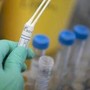 Legionella in case popolari a Milano, un morto e diversi ricoverati