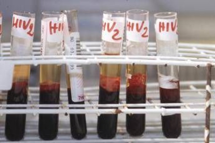 Aids, scoperti 'codici' del sistema immunitario per sospendere le cure