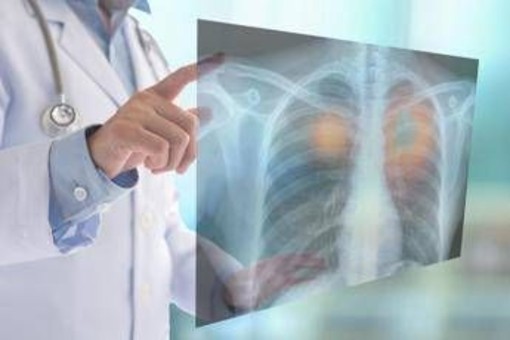 Fine vita, oncologi: &quot;No a Comitato nazionale e a esclusione Ssn, subito confronto&quot;