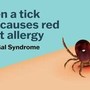 Se una zecca rende allergici a carne e latticini, cos'è la sindrome alfa-gal