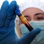 Hantavirus, negativo il turista inglese in quarantena a Milano. Test per una donna ricoverata a Messina Hantavirus, negativo il turista inglese in quarantena a Milano. Test per una donna ricoverata a Messina