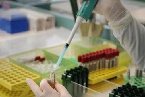 Usa, un decesso per peste in contea Arizona: è il primo caso dal 2007