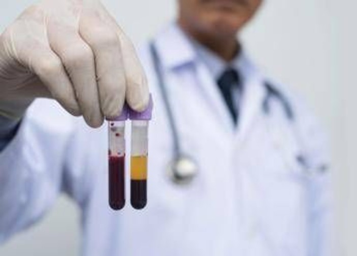 Farmaceutica, Gardini (GenomeUp): &quot;Ai per programmare terapie con plasmaderivati&quot;