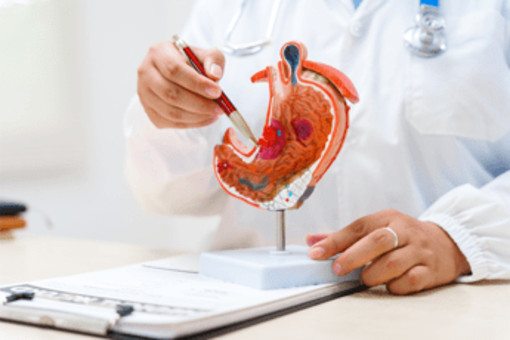 Cancro allo stomaco avanzato, nuova terapia riduce del 42% il rischio di morte Cancro allo stomaco avanzato, nuova terapia riduce del 42% il rischio di morte 
