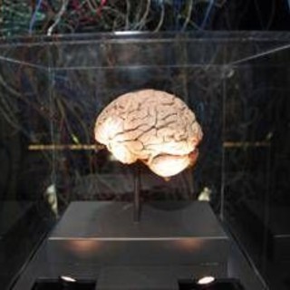 Medicina, neurologi: "L'innovazione può cambiare la storia di molte malattie ma serve equità" Medicina, neurologi: "L'innovazione può cambiare la storia di molte malattie ma serve equità"