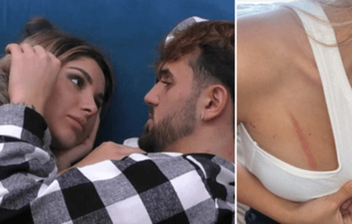 Alfonso D'Apice e Chiara Cainelli derubati dopo il GF: &quot;Due ladre in casa, ci hanno aggrediti&quot;