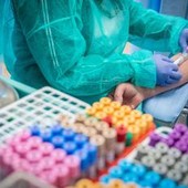Colesterolo, dagli occhi ai piedi tre spie del livello d'allarme Colesterolo, dagli occhi ai piedi tre spie del livello d'allarme