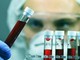 Giornata patologie eosinofile, ematologa Iurlo 'fino a 5 anni per diagnosi'