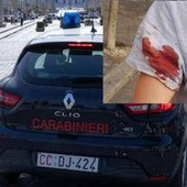 Spari con arma ad aria compressa in centro a Roma, la donna colpita: "Mi hanno detto che si ripetono da giorni" Spari con arma ad aria compressa in centro a Roma, la donna colpita: "Mi hanno detto che si ripetono da giorni"