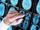 Farmaci, ok Ema a donanemab, neurologi: &quot;Svolta in lotta all'Alzheimer&quot;