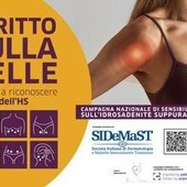 Idrosadenite suppurativa, al via campagna di sensibilizzazione 'Scritto sulla pelle'