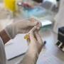 Cancro prostata metastatico ormonosensibile, nuovi dati su darolutamide mostrano benefici in sopravvivenza