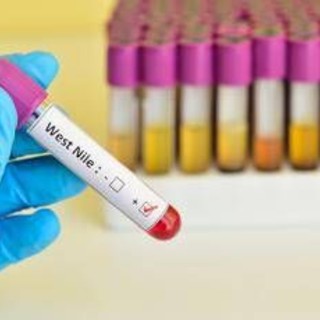 Infezione da West Nile: cos'è la malattia, sintomi e raccomandazioni