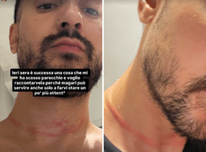 Mr. Daniel, il make-up artist dei vip, aggredito e rapinato a Milano: il racconto choc sui social Mr. Daniel, il make-up artist dei vip, aggredito e rapinato a Milano: il racconto choc sui social