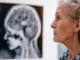 Giornata salute donne, Sin 'prendetevi cura anche della salute neurologica'