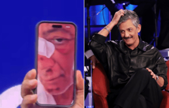 Fiorello, l'incidente in bicicletta: &quot;Volevo fare il figo... sono caduto di faccia&quot;