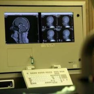 Medicina: Congresso Sin, neurologia tra innovazione, responsabilità e nuova organizzazione Medicina: Congresso Sin, neurologia tra innovazione, responsabilità e nuova organizzazione