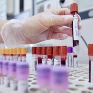 Sibioc, su ipotesi Regione Lazio: &quot;No esternalizzazione medicina di laboratorio&quot;