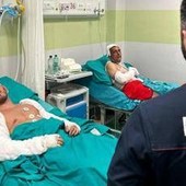 Esplosione Roma, l'agente ferito: &quot;Consapevole del pericolo, lo rifarei&quot;