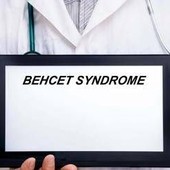 Giornata sindrome Behçet, esperto: "Oggi possiamo prevenire cecità"