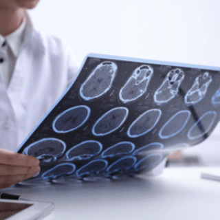 Salute, psicologa Borghi: "Oltre la sclerosi multipla un percorso verso il futuro" Salute, psicologa Borghi: "Oltre la sclerosi multipla un percorso verso il futuro"