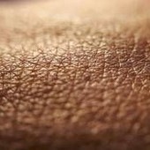 Dermatite atopica, quando la pelle condiziona la vita, 'Diari atipici' dà voce ai pazienti Dermatite atopica, quando la pelle condiziona la vita, 'Diari atipici' dà voce ai pazienti