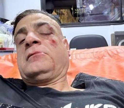 Cicalone, lo youtuber aggredito in metro a Roma: &quot;Infami veri&quot;