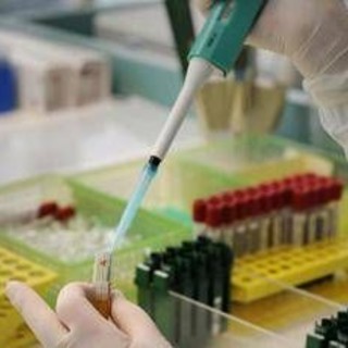 Usa, un decesso per peste in contea Arizona: è il primo caso dal 2007