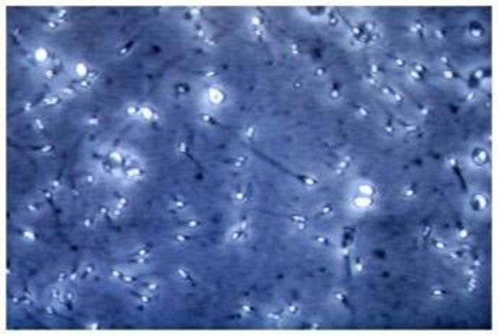 Microplastiche nella prostata e nel liquido seminale, la scoperta italiana: cosa comporta Microplastiche nella prostata e nel liquido seminale, la scoperta italiana: cosa comporta