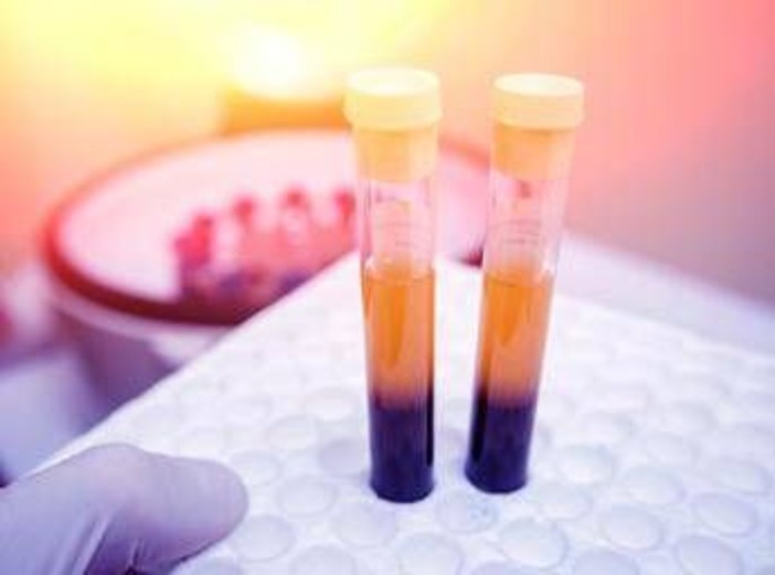Farmaci, Sava (Sif Magazine): &quot;In plasmaderivati attenzione particolare a sicurezza&quot;