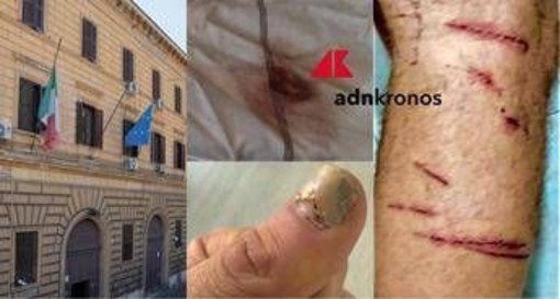 &quot;Picchiato e sequestrato per due giorni da altri detenuti a Regina Coeli&quot;, la denuncia choc