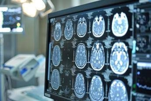Giornata mondiale dell'Alzheimer, neurologi: &quot;Ora percorsi cura più efficaci e sostenibili&quot;