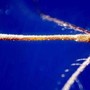 West Nile, seconda vittima in Campania: morto un 74enne