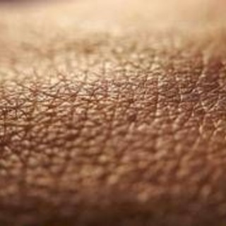 Dermatite atopica, quando la pelle condiziona la vita, 'Diari atipici' dà voce ai pazienti
